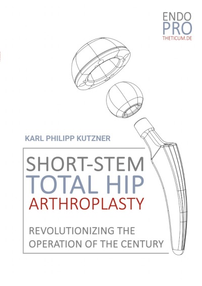 'Cover von Short-Stem Total Hip Arthroplasty'-Cover